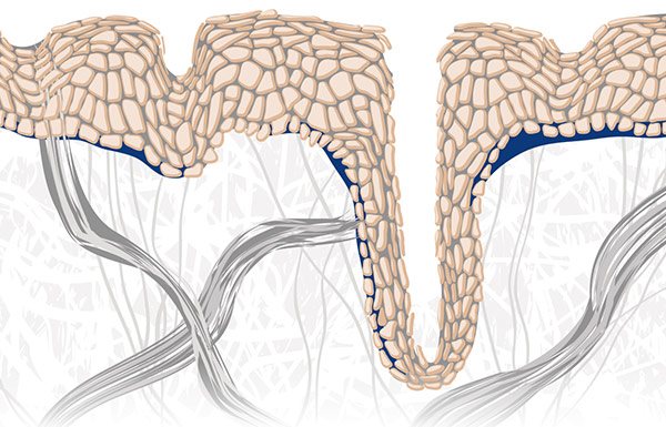 Presentación gráfica de la piel envejecida.