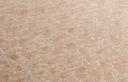 Primer plano de piel seca